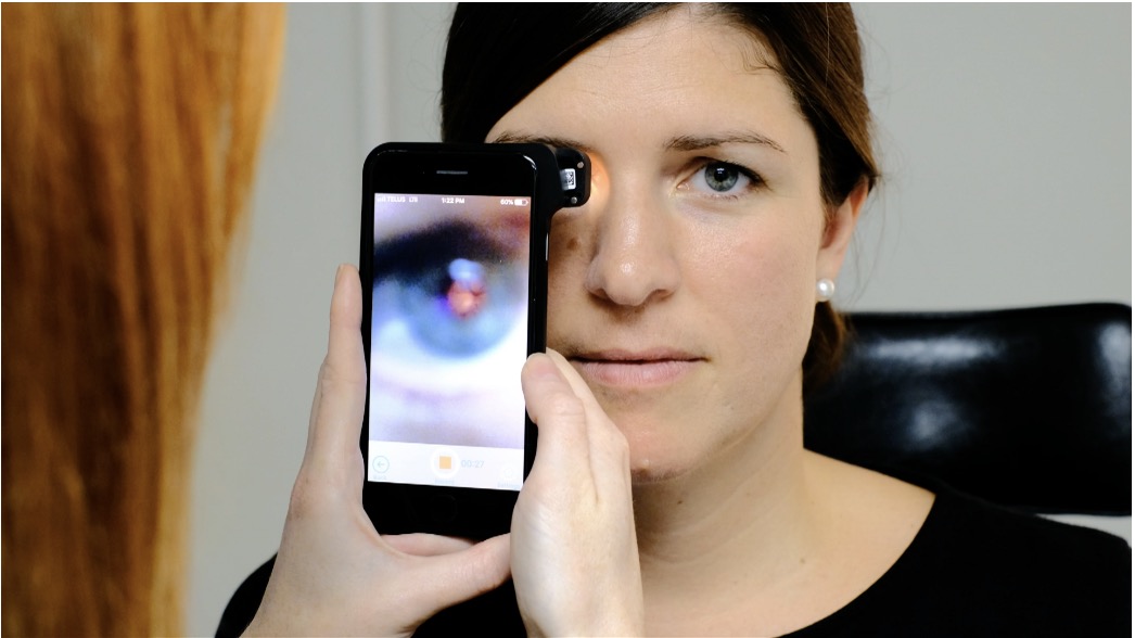 How to use the D-Eye Smartphone Attachment